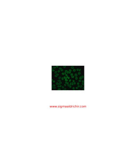 آنتی‌بادی ضد IgG انسانی  Anti-Human IgG (Fc specific)-FITC Antibody produced in goat Sigma F9512