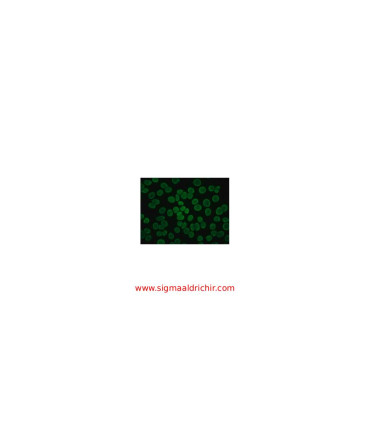 آنتی‌بادی ضد IgG انسانی  Anti-Human IgG (Fc specific)-FITC Antibody produced in goat Sigma F9512