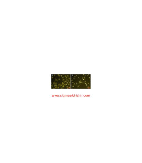 لیپوپلی‌ساکارید از اشریشیا کلی  Lipopolysaccharides from Escherichia coli O111:B4 Sigma L2630