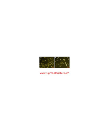 لیپوپلی‌ساکارید از اشریشیا کلی  Lipopolysaccharides from Escherichia coli O111:B4 Sigma L2630